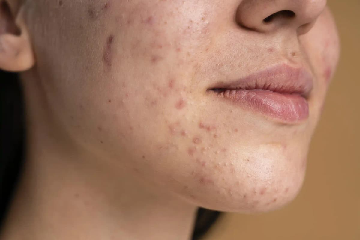 Skin examination